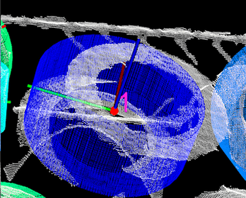 angle threshold after