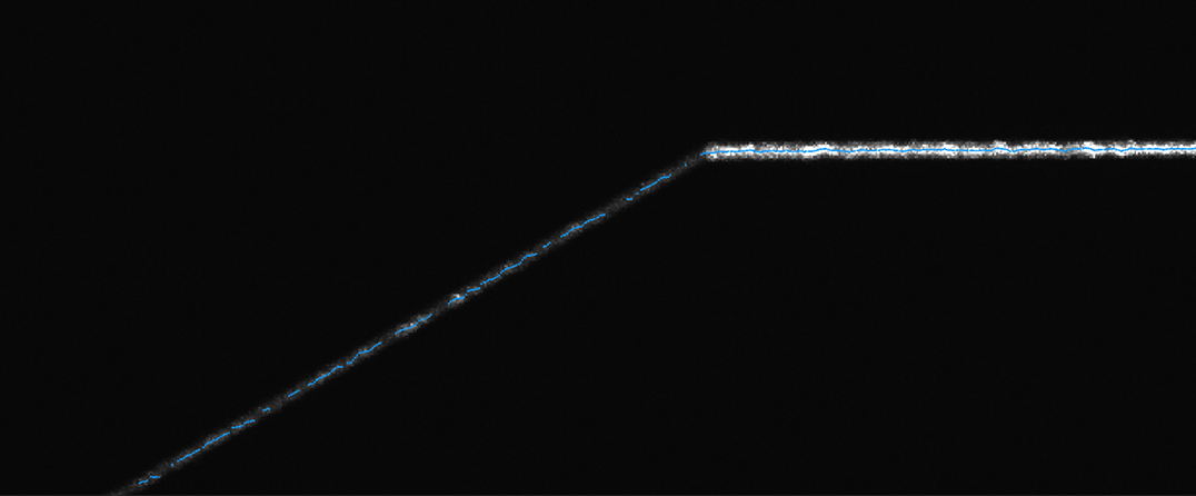 lateral face noncontinuous